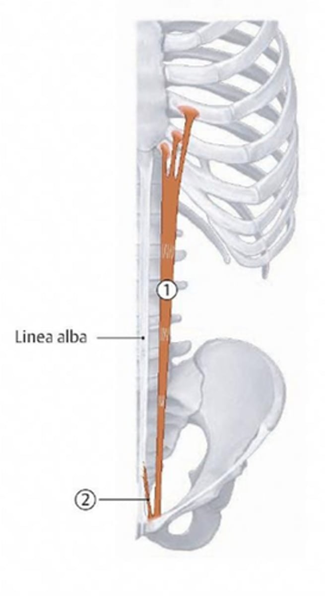 <p>welke spier is hier bij nr 2 aangeduid</p>