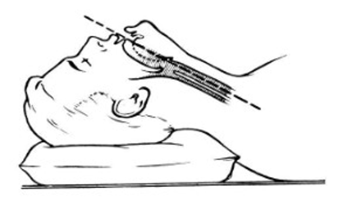 <p>atlanto-occiptal extension</p><p>cervical flexion</p>
