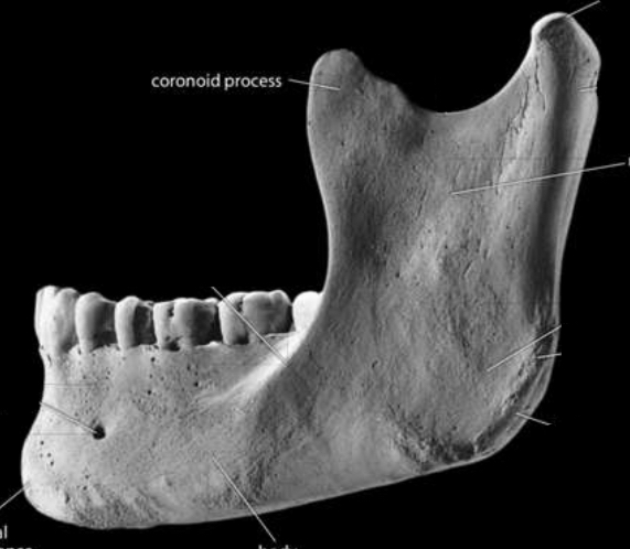 <p>Identify the gonial angle </p>