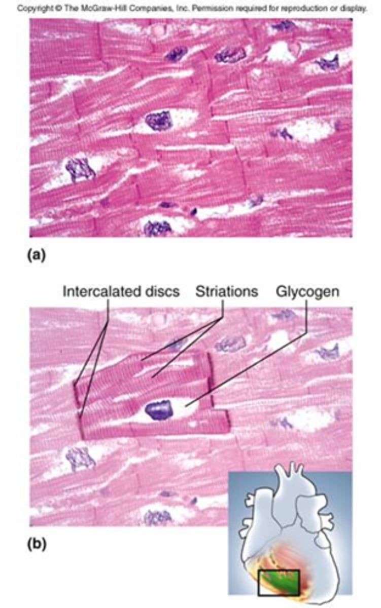 <p>This muscle is found only in the walls of the heart.</p><p>It has striations but it is involuntary.</p><p>The cells (fibers) are branched and join each other at intercalated disks, which are areas where the plasma membranes are connected to each other by gap junctions.</p>