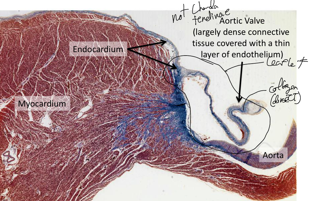 <p>Largely dense connective tissue covered with athin layer of endothelium, NO chorda tendinae.. mostly made of collagen(stained blue)</p>