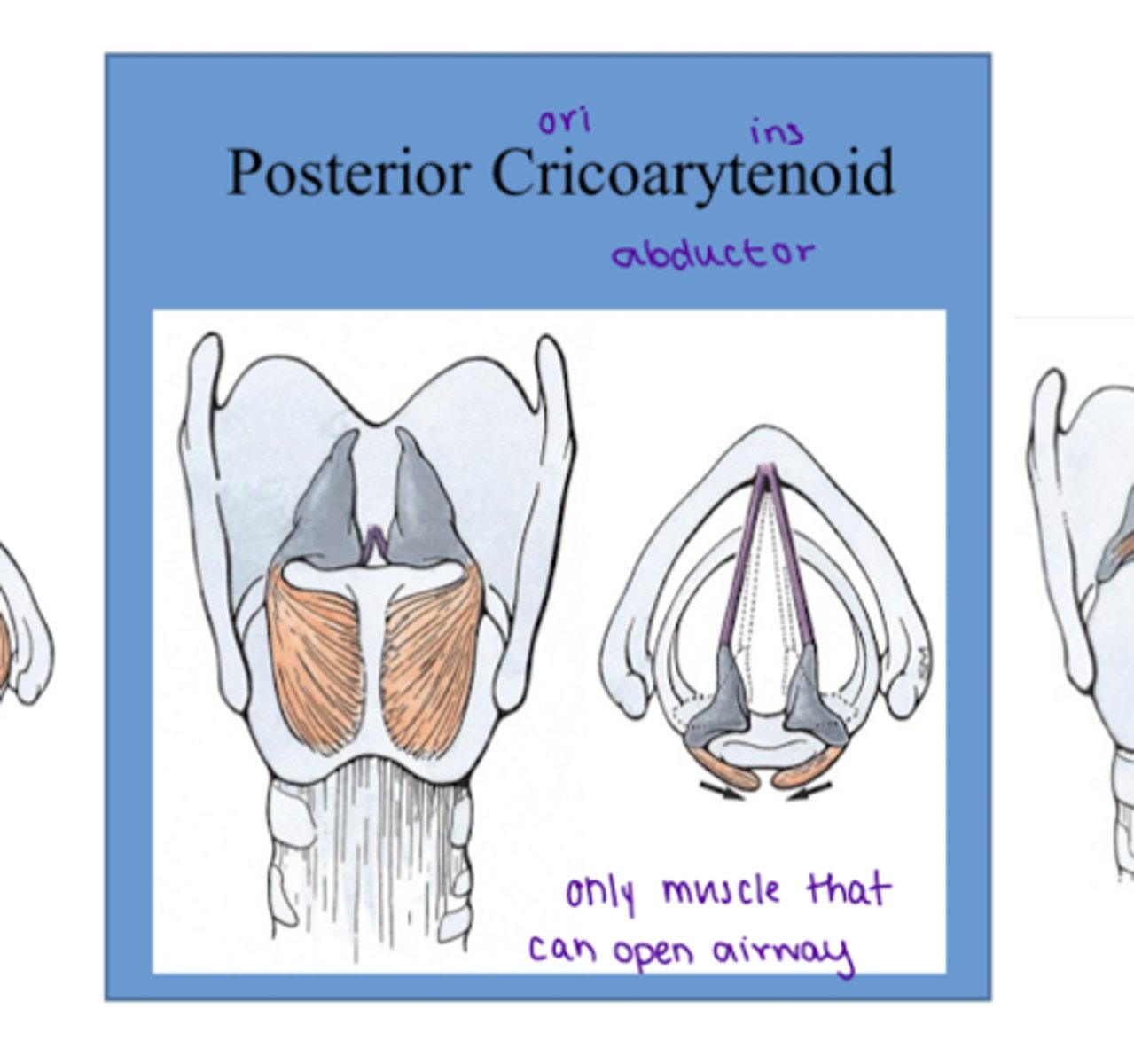 <p>Posterior of the larynx</p><p>Action → pull the arytenoid cartilage backwards → abductor → opens airway</p><p>Only muscle that can open the airway</p>