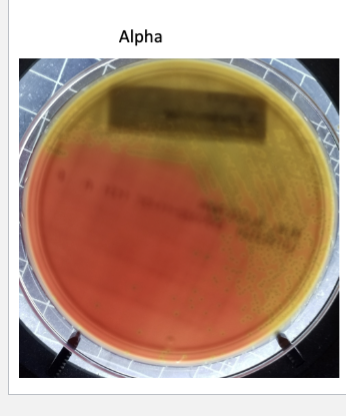 <p>Alpha hemolysis</p>