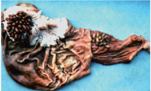 <p>This is a picture of what species of fly bots infection? Is it pathogenic? Treatment?</p>