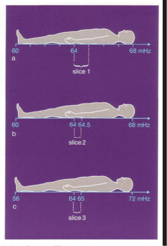 <ul><li><p>In figure c, we use the same range of frequencies or <em>bandwidth, </em>the slice thickness can be modified by the slope of the gradient</p></li><li><p>By using a steeper gradient , the precessional frequencies will vary to a larger degree</p></li><li><p>In figure a and c , the same band width containing frequencies between 64 and 65 mHz was used both times</p></li><li><p>Because of the steeper gradient in c was used, we produce a thinner slice</p></li></ul><p></p>