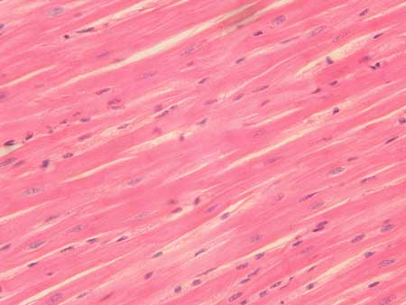 <p>Tissue for contraction and movement; includes skeletal, cardiac, smooth.</p>