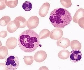 <ul><li><p>are also macrophages (“small eaters”) that are numerous in the blood.</p></li><li><p>increases when there is bacterial infection</p></li><li><p>w/ pinkish or lilac granules</p></li></ul><p></p>