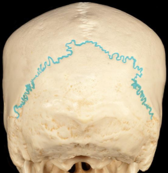<p>Which cranial suture is this? (1)</p>