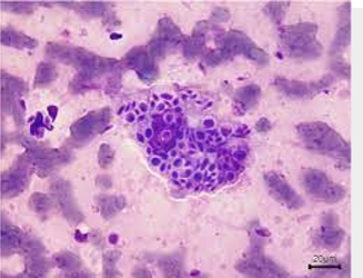 <p>what is the fungus that is cigar shaped, elongated, pleomorphic yeast in tissue?</p>