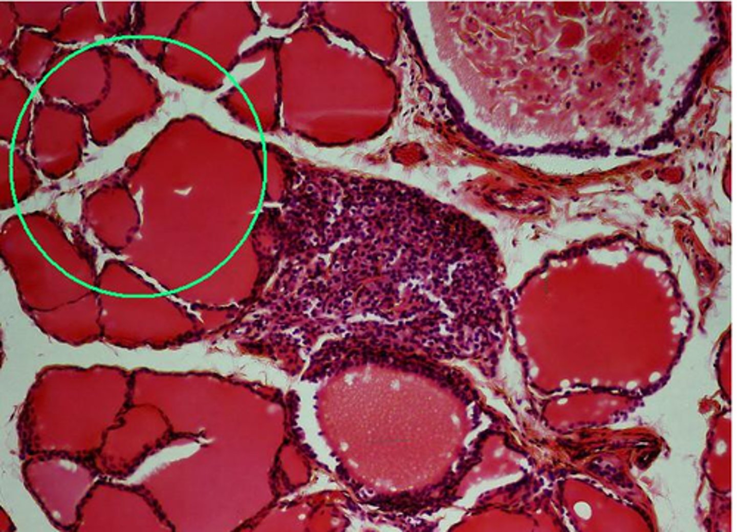 <p>What endocrine gland does the indicated region belong to?</p>