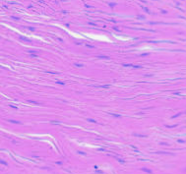 <p>what type of tissue is this?</p>