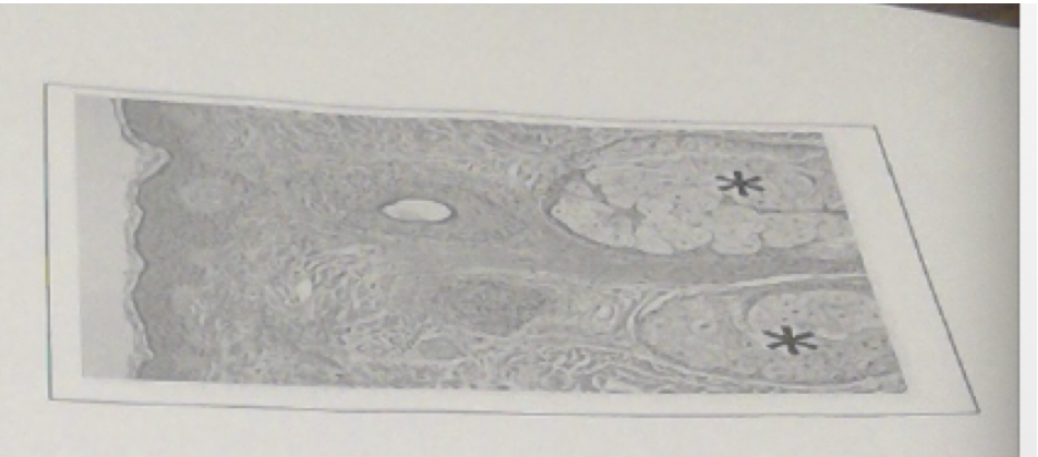 35\. The structures indicated by the asterisks