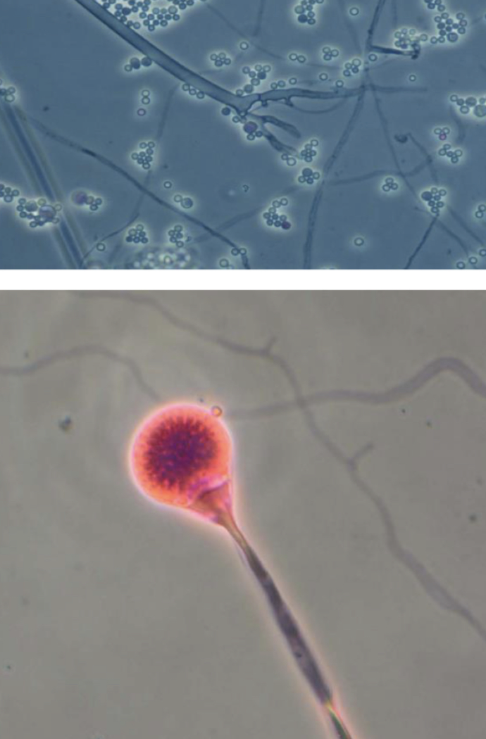 <p>Lichtheimia corymbifera</p>