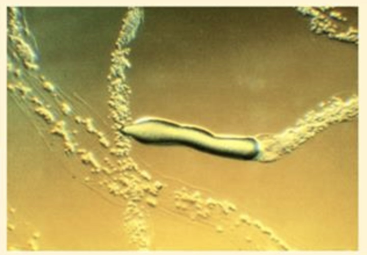 <p>a slightly motile aggregation of cells (slug) that produces fruiting bodies, which in turn produce spores; cells aggregate via AMP hormone</p>