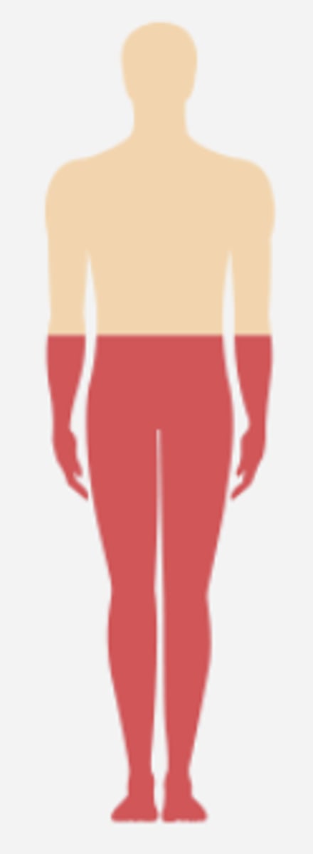 <p>% of complete paraplegia</p>