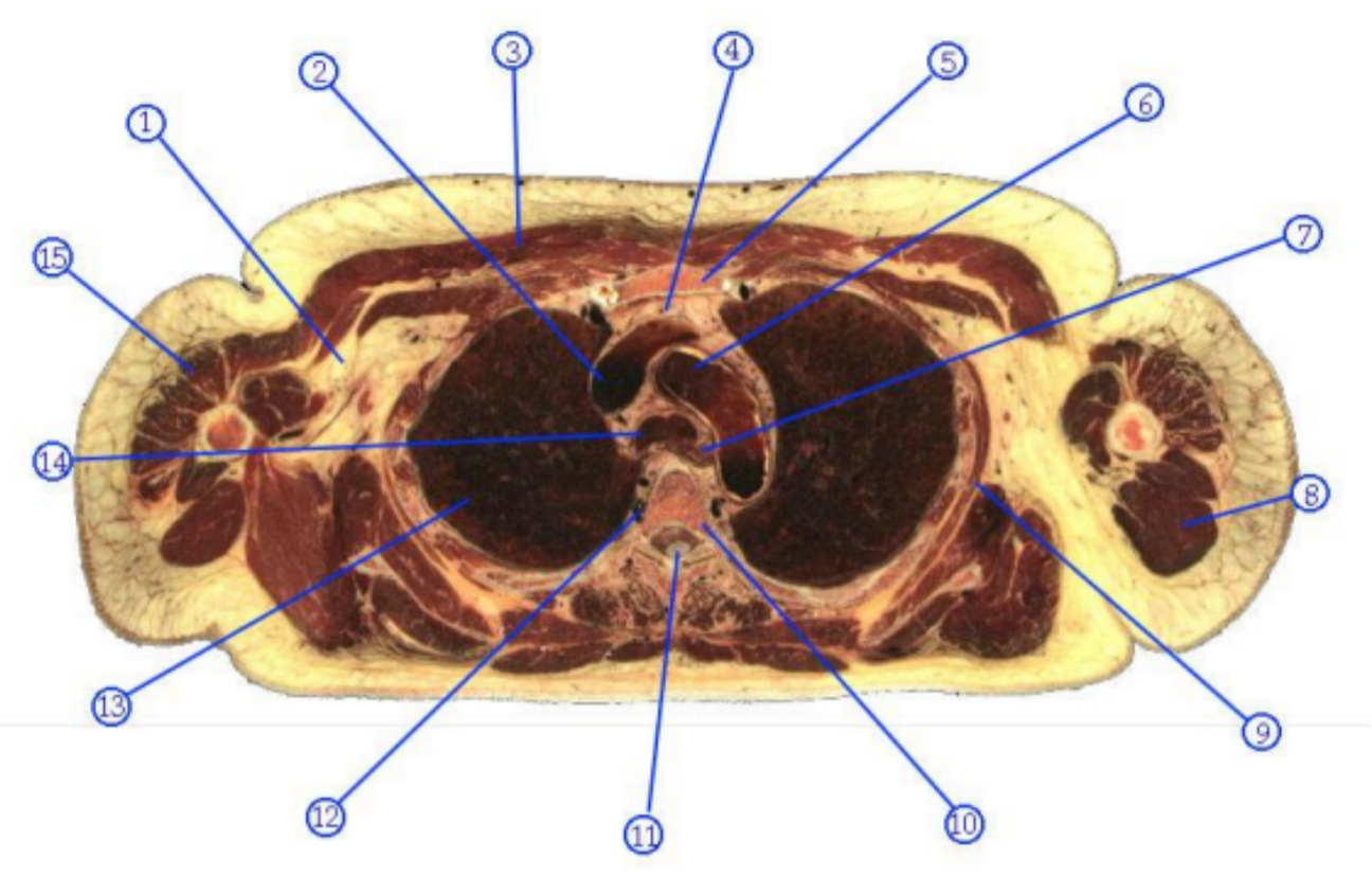 <p>What is structure 3?</p>