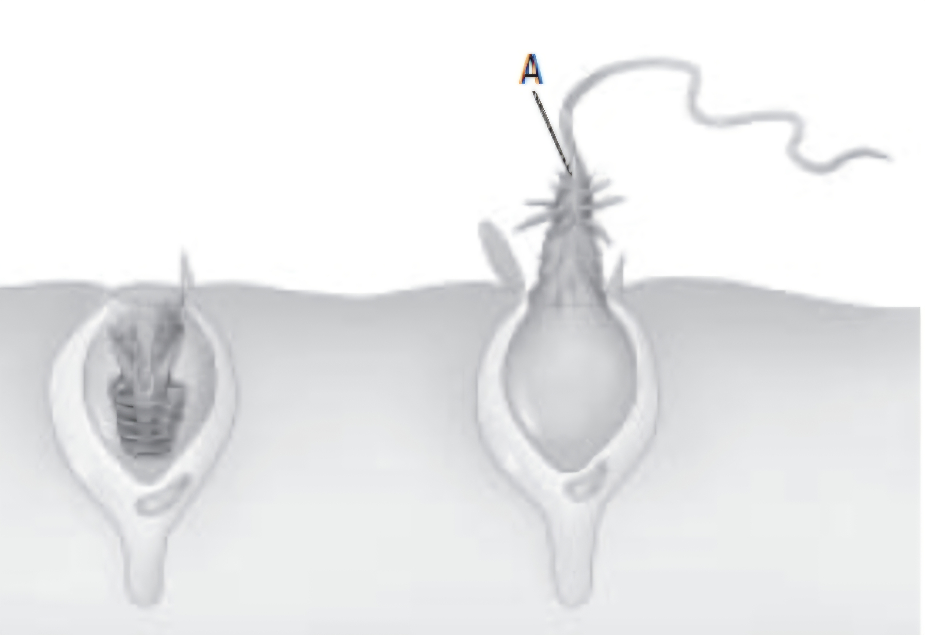 <p>At the beach you are stung by a jellyfish. In the diagram below, what is the structure labeled A on the cnidarian tentacle that holds a tube that contains poison?</p>
