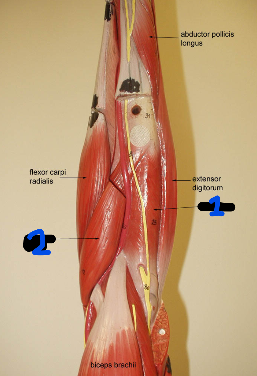 <p><span style="font-family: Arial, sans-serif">What muscle will you find at 1?</span></p>