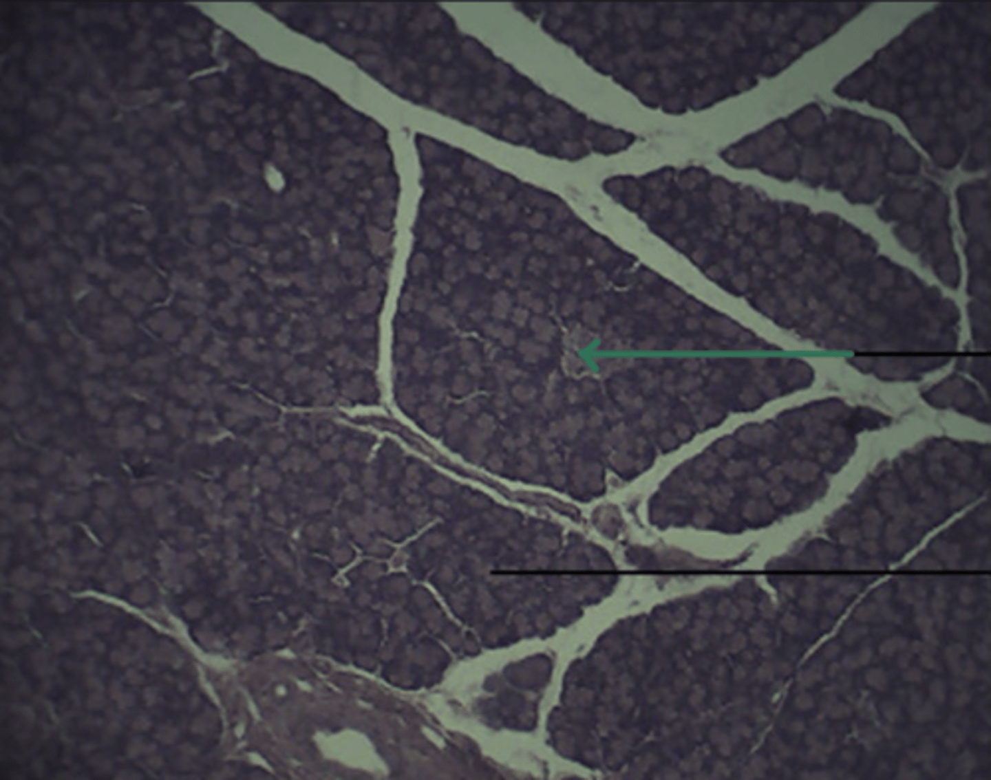 <p>gland and structure</p>