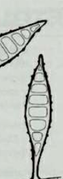 <p>what type of asexual spore is this</p>