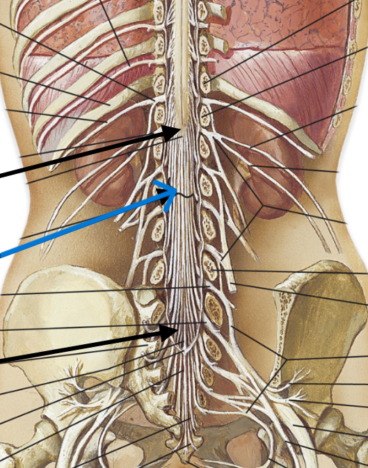 <p>Which part of the spinal cord is:</p><ul><li><p>Roots below conus medullaris</p></li><li><p>Start around L1</p></li></ul><p></p>