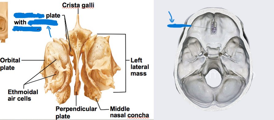 <p>What is this part of the ethmoid?</p>