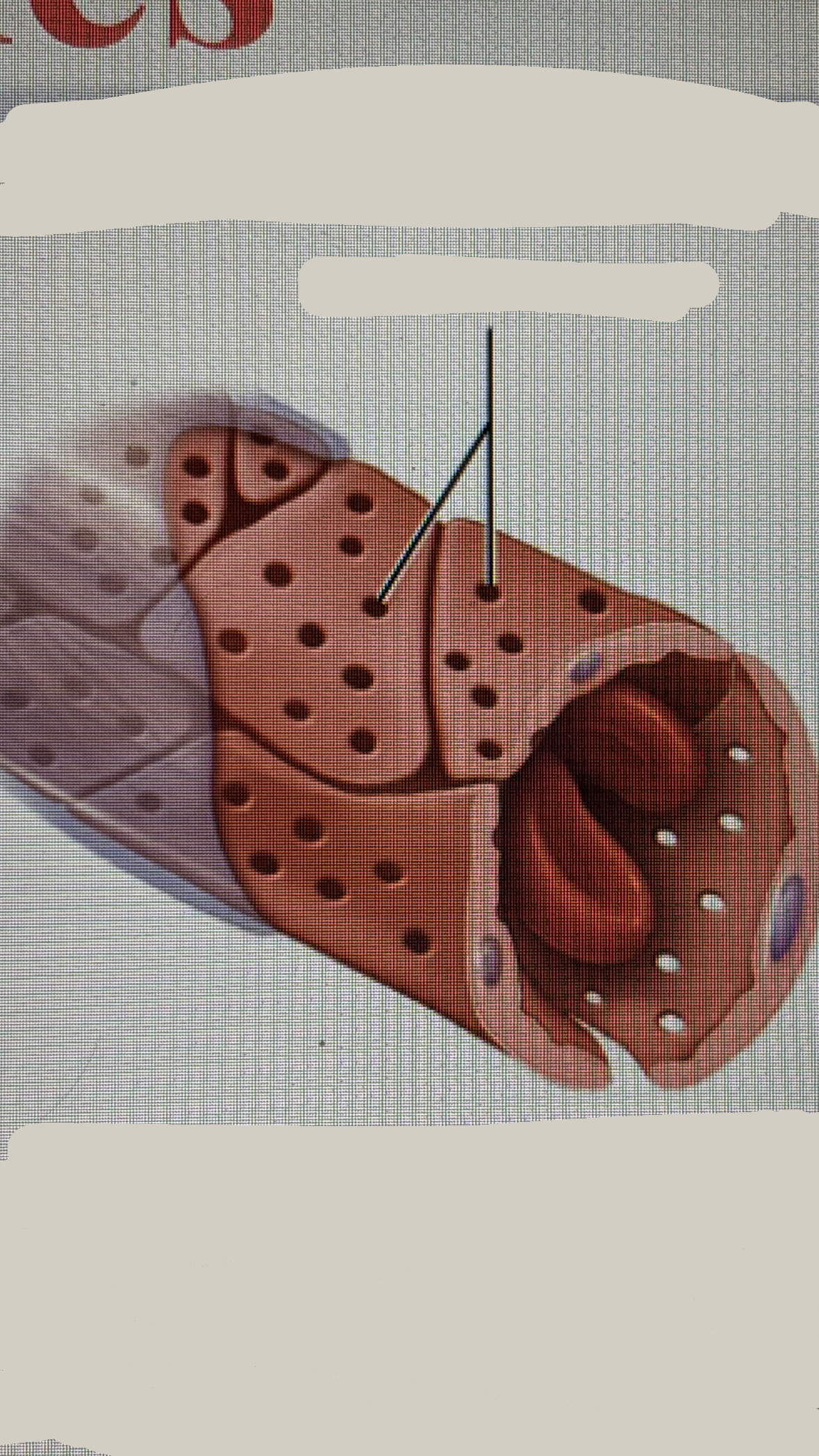 <ul><li><p>contains fenestrations in the endothelial cells</p></li><li><p>LOCATION</p></li></ul><p>      Kidneys, endocrine glands, small intestine </p><p>moderately leaky- allow large volumes of fluid and larger substances to cross capillary walls</p><p></p>