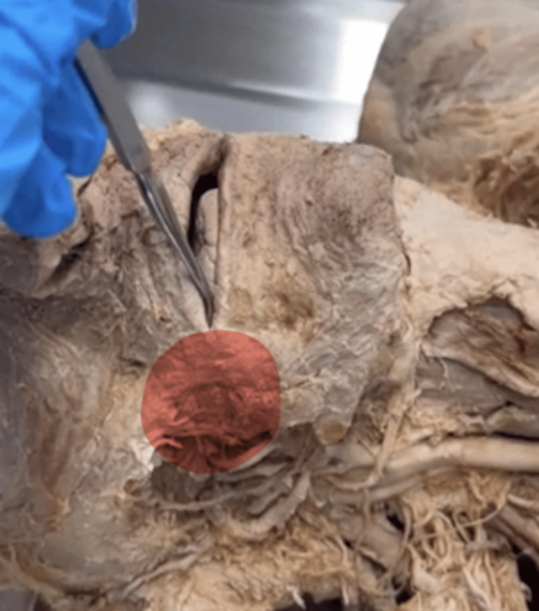 <p>Name the cavity.</p>