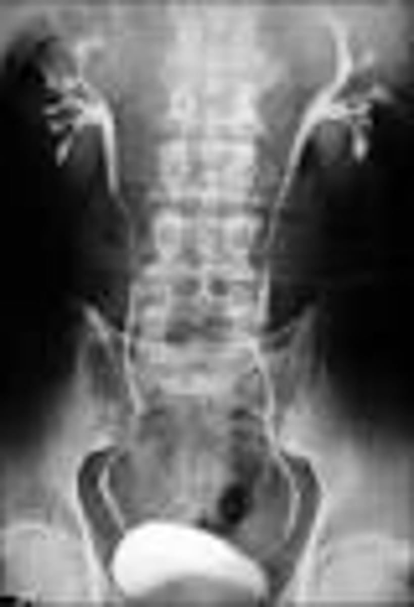 <p>To help visualize the urinary system during imaging exams.</p>