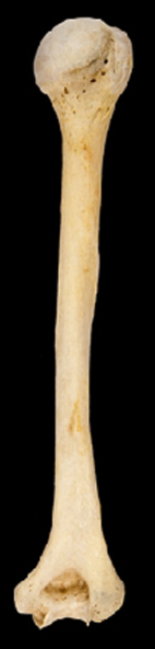 <p>What bone is this?</p><p>Left side or right side?</p><p>(Posterior view).</p>