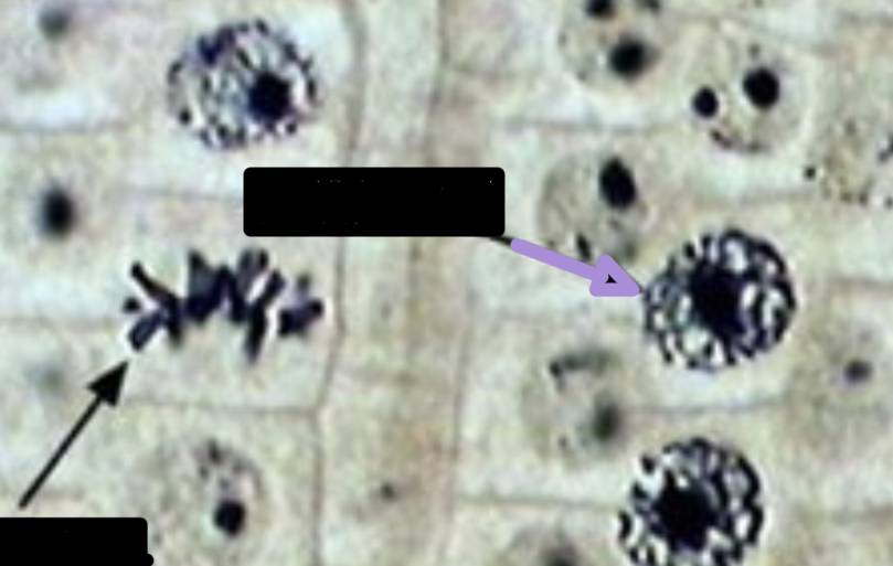 <p>prophase </p>