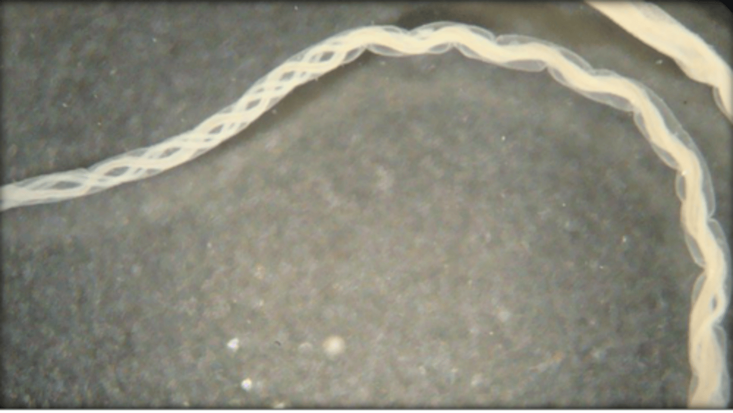 <p>What is this parasite? What characteristic/s did you use to identify it?</p>