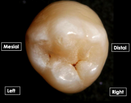 <p>tooth ID</p>