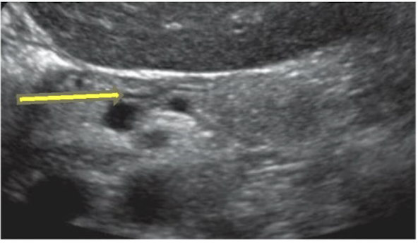 <p>What is the yellow arrow pointing to?</p>