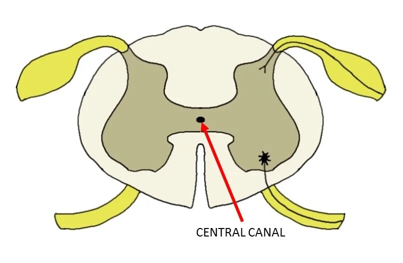 <p>a fluid-filled channel that runs through the center of the spinal cord, connecting to the brain's ventricular system</p>