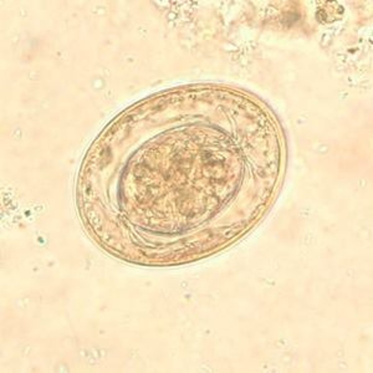 <p>has polar filaments</p>