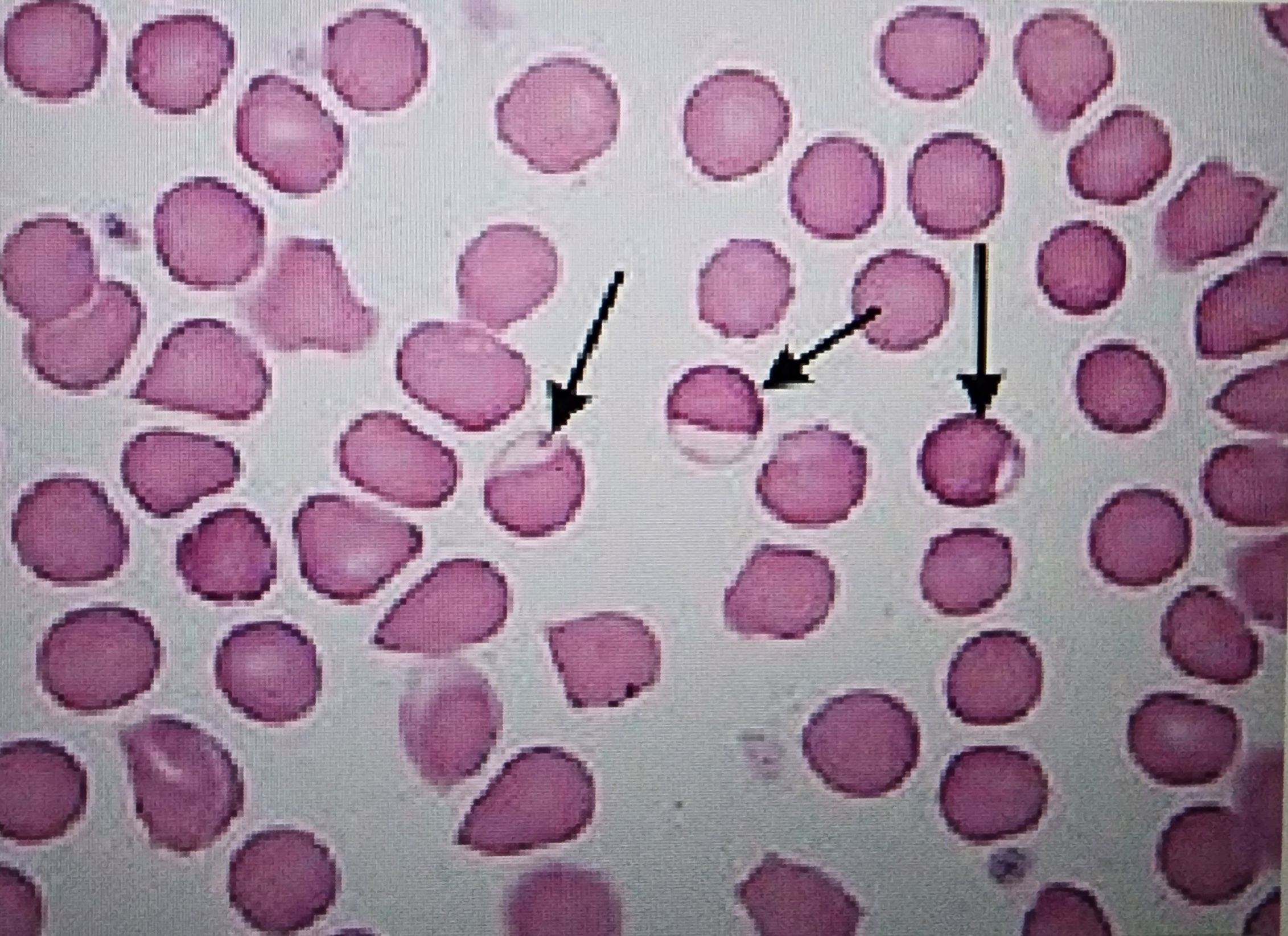 <p>fused membrane on 1 side that looks empty</p>