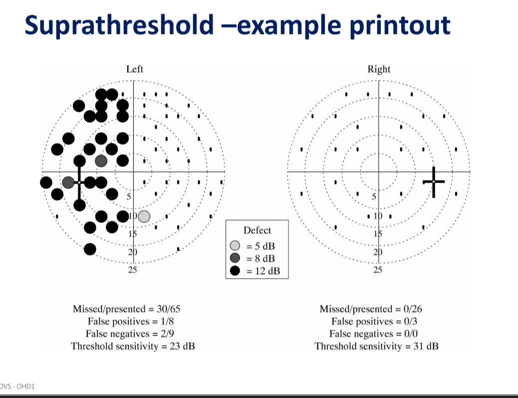<p>Stimuli brighter than expected threshold so patient is expected to see all the stimuli presented </p><p>If pt misses a stimulus it can be presented again and if they still miss it a brighter stimulus can be presented in the same location </p>