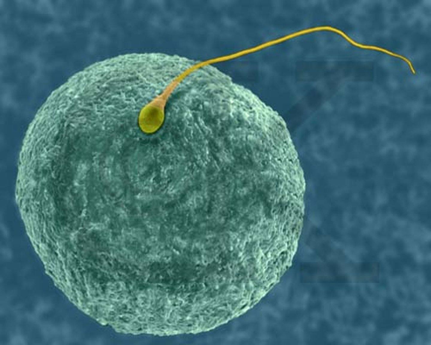 <p>Sperm</p>