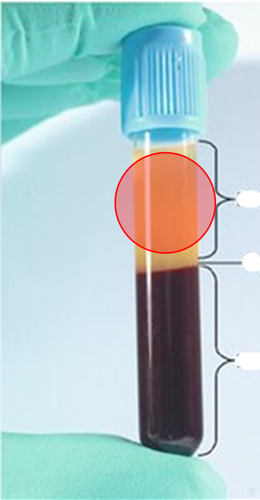 • The top layer of centrifuged blood.

• Consists of mostly water with proteins, nutrients, electrolytes, enzymes, hormones, waste products, and gases.