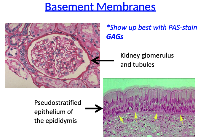 <ul><li><p>Basement membranes <strong>show up best with PAS stain</strong> (due to <strong>GAGs</strong>)</p></li></ul><p></p>