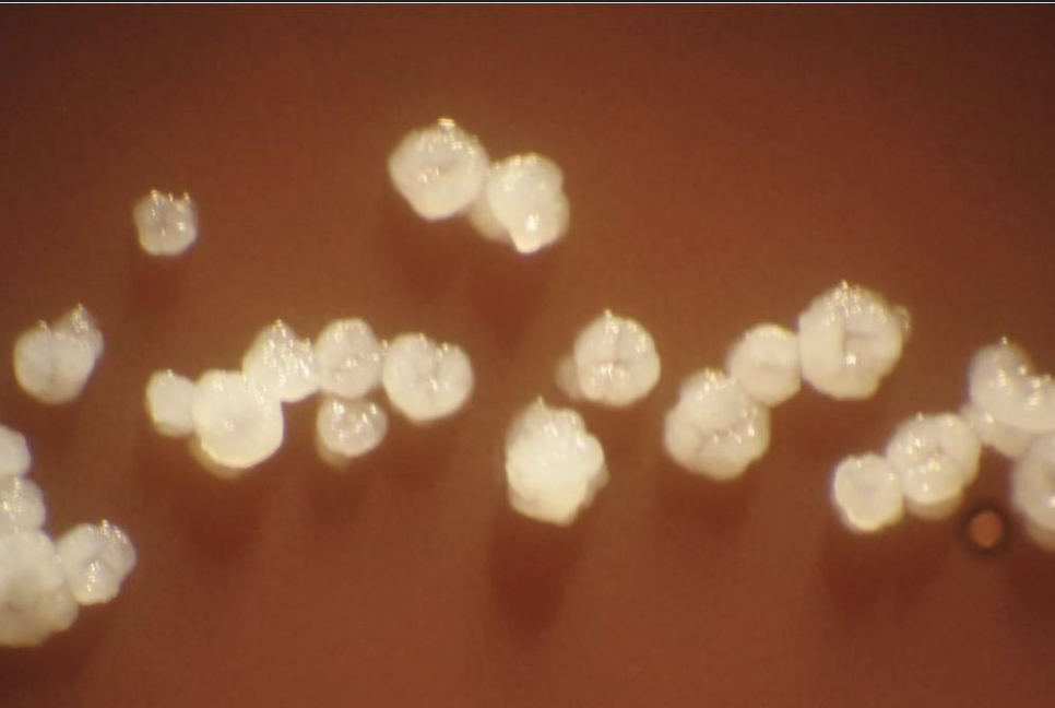 <p>“molar tooth”</p>