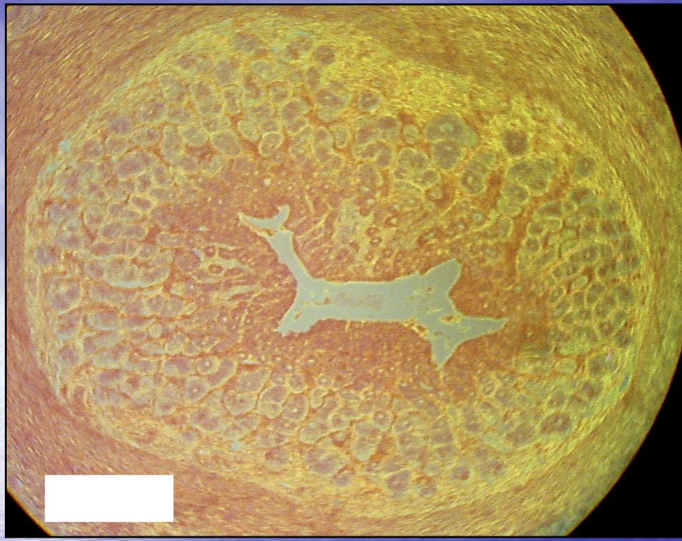 <p>Which phase of estrus is this ovary experiencing?</p>