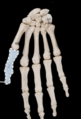 <p>Bones of the hand, anterior view, right side</p>