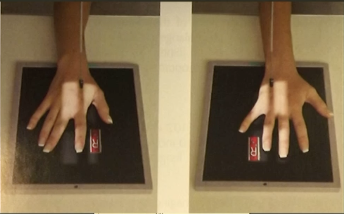 <p>Fine FS, 100cm</p><p>55kVp/1mAs</p><p>Straight tube</p><p>CR: Distal portion of proximal phalanx</p>