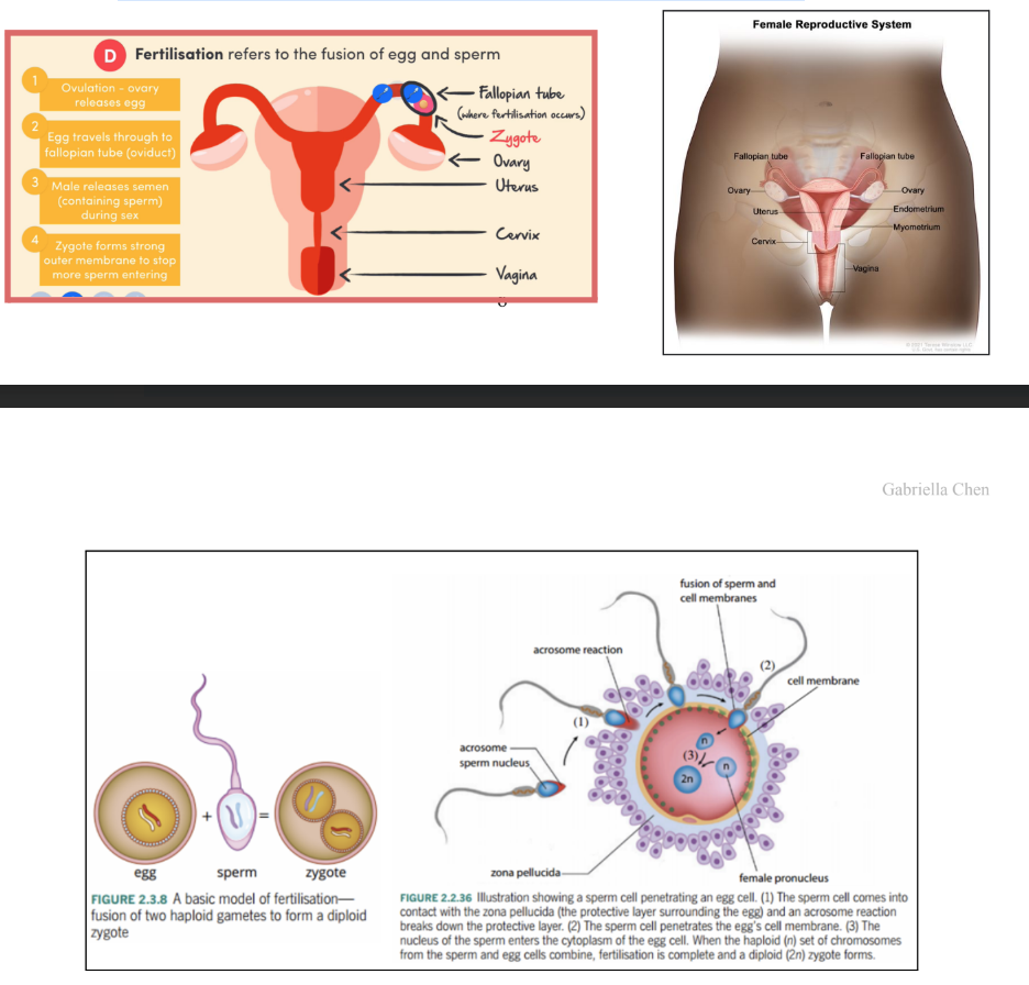 <p>*Fertilisation happens in the fallopian tube</p><p>**Implantation in uterus (if it happens in the fallopian tubes, it is an ectopic pregnancy where the embryo will not survive</p><p>as miscarriage will occur)</p><p>Pregnancy and Birth in Mammals</p><p>Mammal: An organism that is warm blooded, has a back bone and is able to produce milk and has hair</p><p>● Placental mammals* develop a placenta at implantation e.g. Humans</p><p>● Marsupials rely on a pouch to protect the embryo as it develops e.g. Kangaroo</p><p>● Monotremes rely on an egg to protect the embryo as it develops e.g. Platypus</p><p>*NOTE: Placental mammals are the main focus</p><p>󰘳Fertilisation [fusion of male and female gametes]</p><p>In mammals, the male ejaculates sperm into the female’s reproductive tract for internal fertilisation in the</p><p>oviduct*</p><p>● During fertilisation, the haploid** sperm nucleus fuses with the ovum nucleus. The ovum provides a</p><p>single set of chromosomes, and the sperm provides a complementary set of chromosomes. → Produces</p><p>a Zygote - single cell</p><p>● The ovum*** also provides nutrients for the growth of the embryo and regulatory factors that control</p><p>early development → as in, the ovum has all the other organelles (e.g. mitochondria. [RECALL: mitochondrial DNA],</p><p>sperm only gives half genetic information</p><p>○ Makes sure that it develops properly</p><p>*Oviduct = fallopian tubes</p><p>**Half genetic information (Haploid)</p><p>***Ovum = egg</p><p>STEPS:</p><p>1) The female’s body releases an egg from the ovary (ovulation).</p><p>a) In humans it happens about once a month around day 14 (middle of the cycle)</p><p>2) Egg travels through the oviduct which is where fertilisation will occur</p><p>3) The male releases semen (a fluid containing sperm) into the vagina during sex. Sperm swims through</p><p>the cervix and the uterus, to the oviduct where the egg is waiting. Here the nuclei of a sperm cell and the</p><p>egg fuse to form a zygote</p><p>4) The zygote forms a strong membrane to stop other sperm from entering</p><p>a) Otherwise there will be TOO MANY CHROMOSOMES - we only want ONE set</p><p></p>