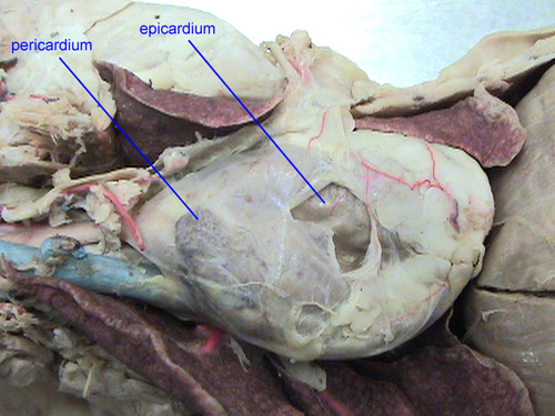 <p>Pericardium</p>