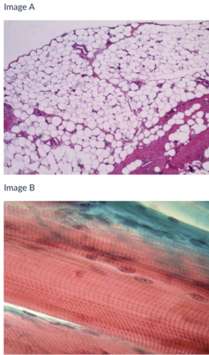 <p>Which of the following tissues is contractile?</p><p>A</p><p>B</p><p>Both</p><p>Neither</p>
