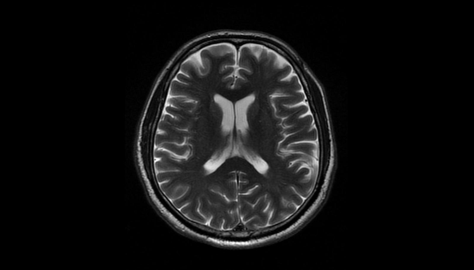 <p>Magnetic Resonance Imaging</p>