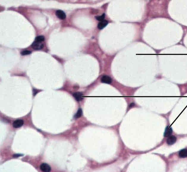 <p>Fat cells, circular cells “adiPOSE” “PotaTOES”</p>